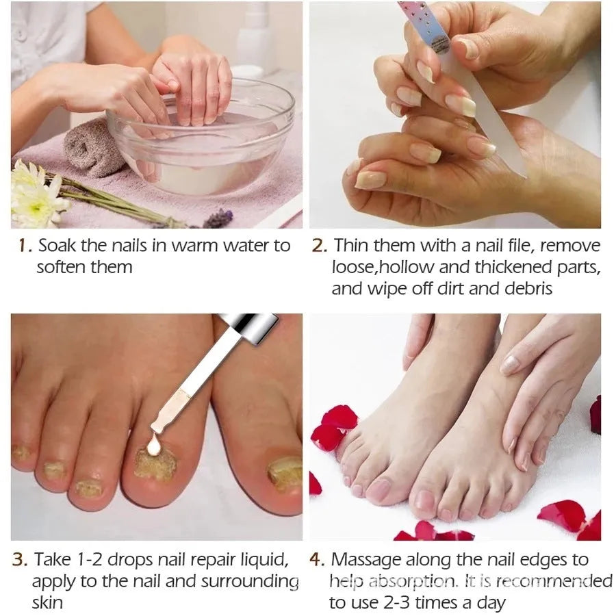 Deck Liquid Antimicrobial 10ml whitening antibacterial foot treatment cream bottle