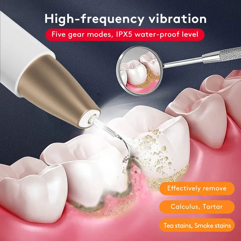 Gold ultrasonic tooth cleaner for tartar and stain removal, portable oral care device