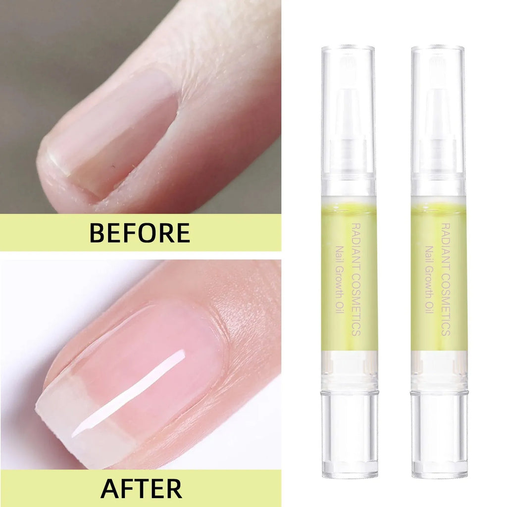 3ml bottle of wash-free nail growth and moisturising treatment oil.