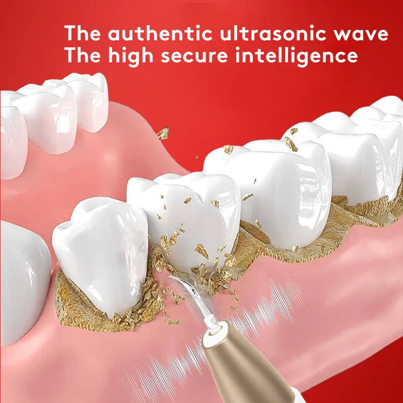 Gold ultrasonic tooth cleaner for tartar and stain removal, portable oral care device